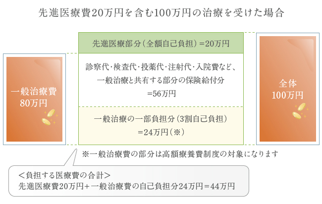 先進医療費20万円を含む100万円の治療を受けた場合